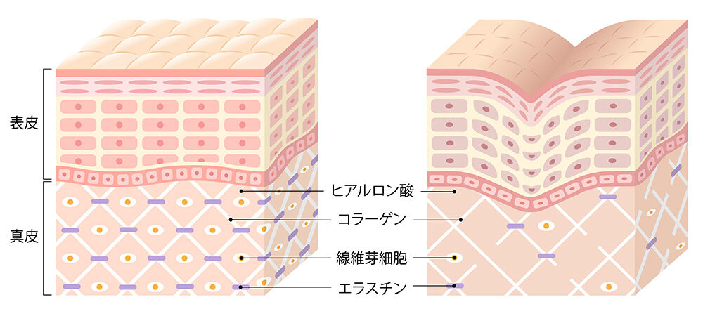 肌の構造