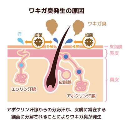 ワキガの発生原因