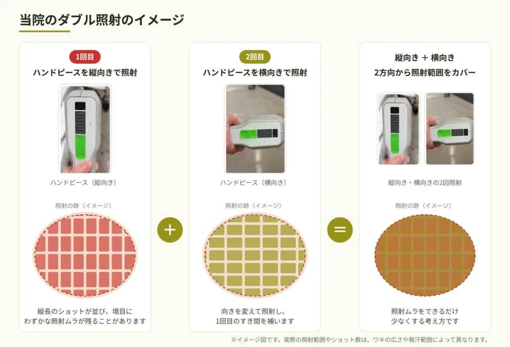 ミラドライのダブル照射のイメージ図。1回目はハンドピースを縦向き、2回目は横向きにして照射し、2方向から照射範囲をカバーする